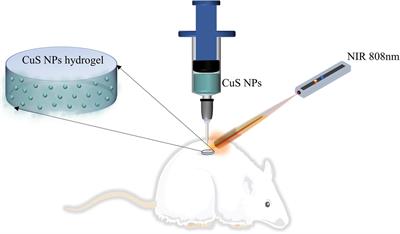 Copper Sulfide Nanoparticles-Incorporated Hyaluronic Acid Injectable Hydrogel With Enhanced Angiogenesis to Promote Wound Healing